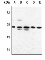 Glucagon Receptor Rabbit Polyclonal Antibody