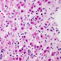 Glucagon Receptor Rabbit Polyclonal Antibody