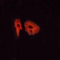 Glucagon Receptor Rabbit Polyclonal Antibody