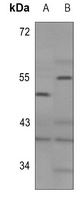 GHRH Receptor Rabbit Polyclonal Antibody