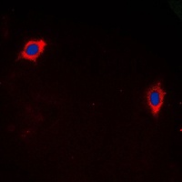 GHRH Receptor Rabbit Polyclonal Antibody