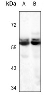 Glycerol Kinase 1 Rabbit Polyclonal Antibody