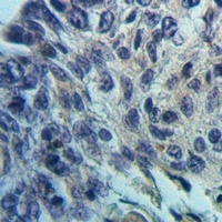 Glycerol Kinase 1 Rabbit Polyclonal Antibody