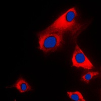 Glycerol Kinase 1 Rabbit Polyclonal Antibody