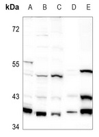 GNAI1 Rabbit Polyclonal Antibody