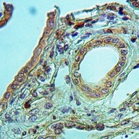 GPIPLD Rabbit Polyclonal Antibody