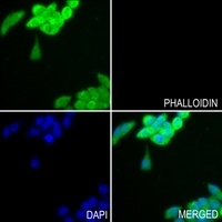 GPIPLD Rabbit Polyclonal Antibody