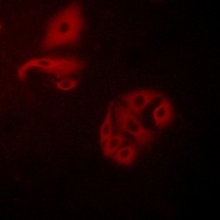 GPR20 Rabbit Polyclonal Antibody