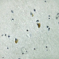 GRB10 (Phospho-Y67) Rabbit Polyclonal Antibody