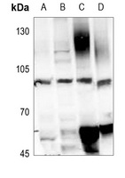GLUR1 (Phospho-S849) Rabbit Polyclonal Antibody