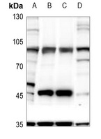 GLUR4 (Phospho-S862) Rabbit Polyclonal Antibody