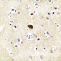 GLUR4 (Phospho-S862) Rabbit Polyclonal Antibody