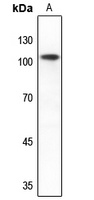 mGLUR2 Rabbit Polyclonal Antibody
