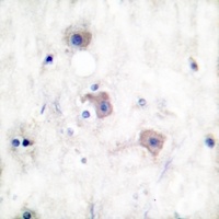 mGLUR2 Rabbit Polyclonal Antibody