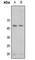 GSK3 alpha (Phospho-S21) Rabbit Polyclonal Antibody