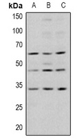 GSK3 beta (Phospho-S9) Antibody