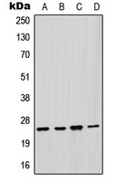 GSTM2 Rabbit Polyclonal Antibody