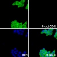 GSTM2 Rabbit Polyclonal Antibody