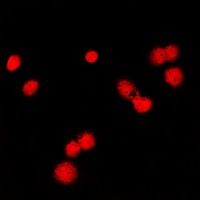 MSH6 Rabbit Polyclonal Antibody