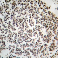 GYS1 Rabbit Polyclonal Antibody