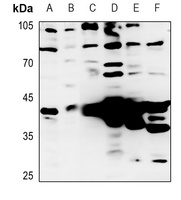 Granzyme B/H Antibody