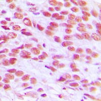 Histone H2A.X Rabbit Polyclonal Antibody