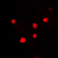 Histone H2A.X Rabbit Polyclonal Antibody