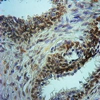 Histone Deacetylase 1 (Phospho-S421) Rabbit Polyclonal Antibody