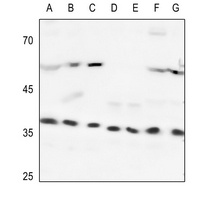 Heme Oxygenase 2 Rabbit Polyclonal Antibody
