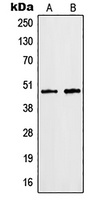 hnRNP F Rabbit Polyclonal Antibody