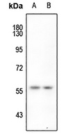 hnRNP K (Phospho-S284) Rabbit Polyclonal Antibody
