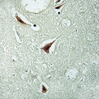 hnRNP K (Phospho-S284) Rabbit Polyclonal Antibody