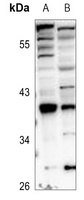 HOXA1 Rabbit Polyclonal Antibody
