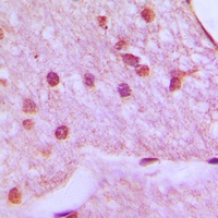 HOXA1 Rabbit Polyclonal Antibody