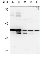HOXB2 Rabbit Polyclonal Antibody