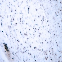 HOXB2 Rabbit Polyclonal Antibody