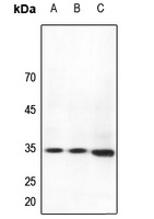 HOXB4 Rabbit Polyclonal Antibody