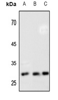 HOXB7 Rabbit Polyclonal Antibody