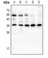 HOXB9 Rabbit Polyclonal Antibody