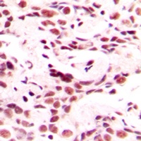 HOXB9 Rabbit Polyclonal Antibody