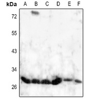 HOXD8 Rabbit Polyclonal Antibody