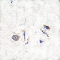 NRAS/HRAS/KRAS Antibody