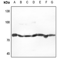 GRP78 Rabbit Polyclonal Antibody