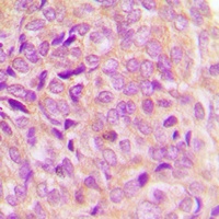 GRP78 Rabbit Polyclonal Antibody