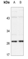 HSP27 (Phospho-S15) Antibody