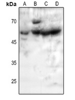 5-HT2B Rabbit Polyclonal Antibody