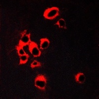 5-HT2B Rabbit Polyclonal Antibody