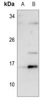 ID1 Rabbit Polyclonal Antibody