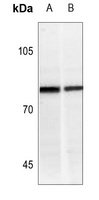 IFNGR1 (Phospho-Y457) Antibody
