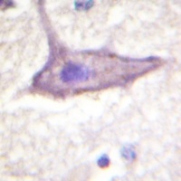 IFNGR1 (Phospho-Y457) Antibody